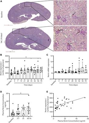 Mildly Increased Renin Expression in the Absence of Kidney Injury in the Murine Transverse Aortic Constriction Model